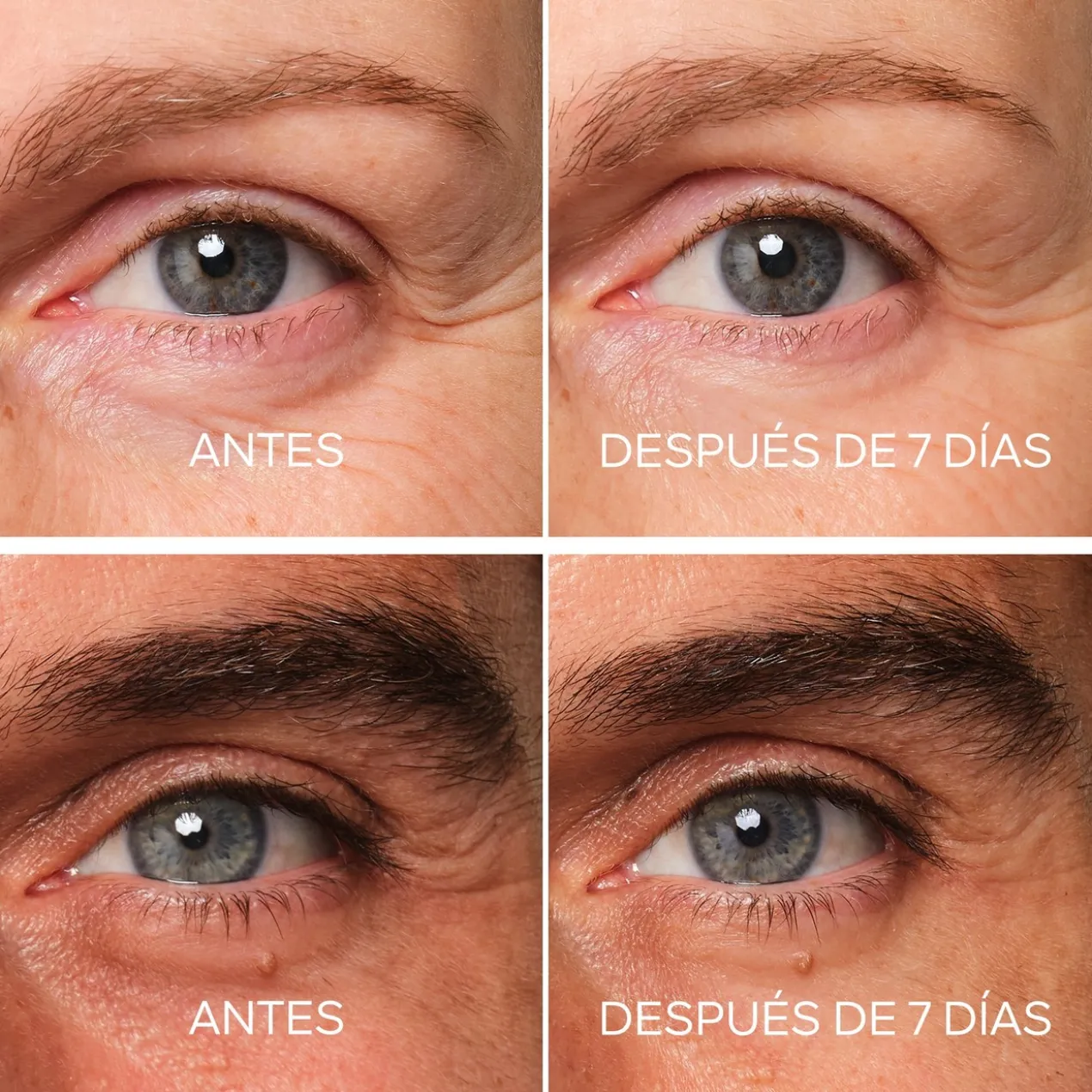 Abeille Royale Tratamento de Olhos Reparador de Juventude