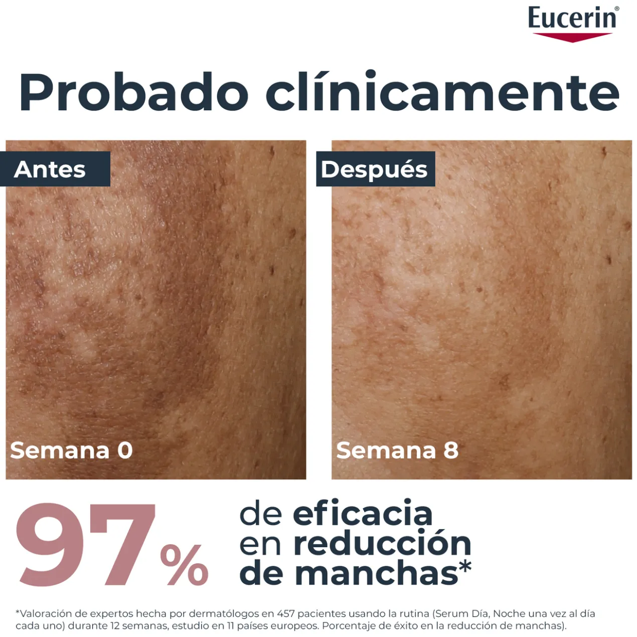 Anti-Pigment Creme de Dia SPF30