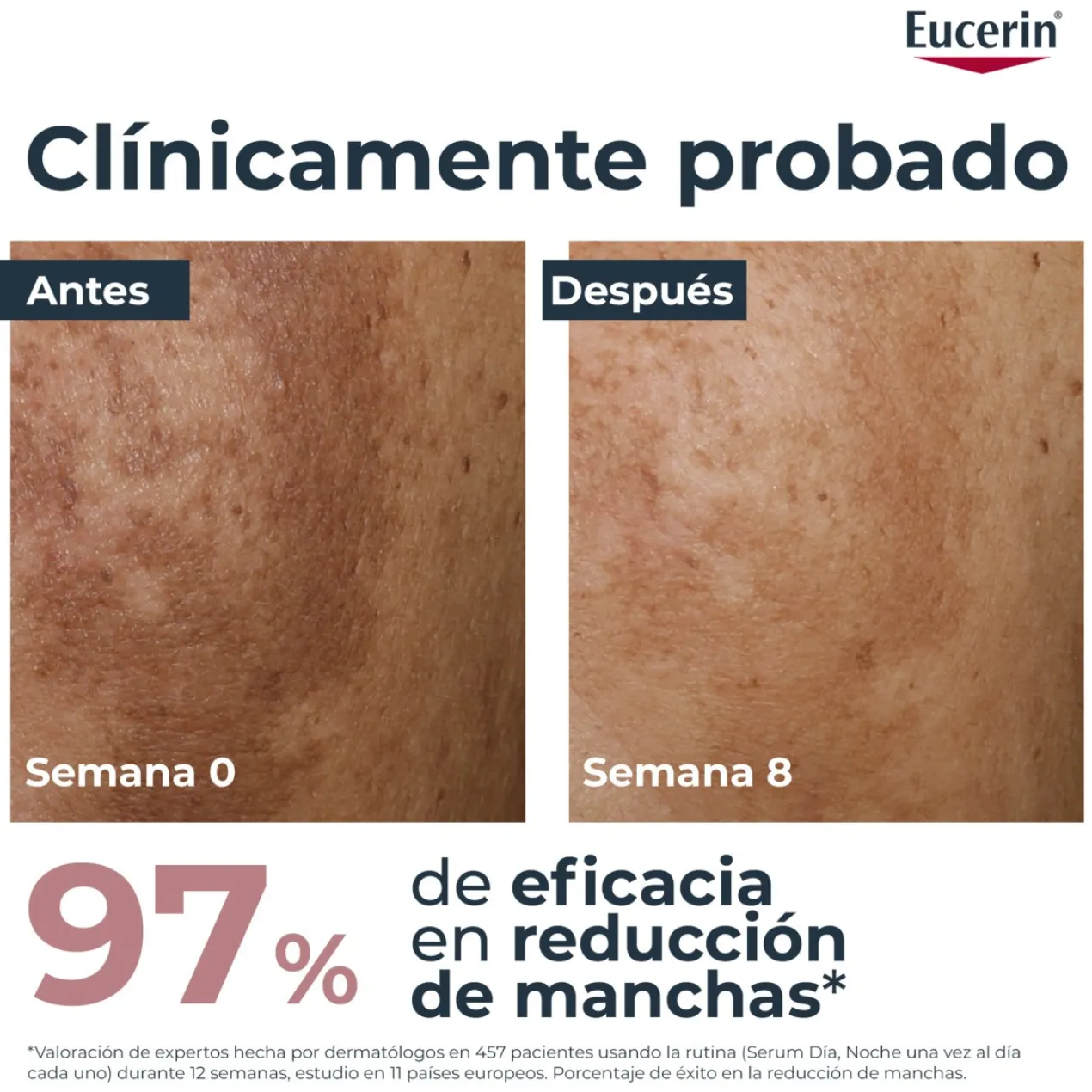 Anti-Pigment Dual Sérum Antimanchas
