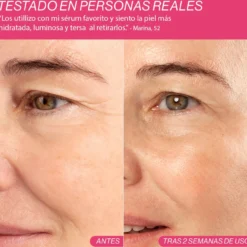 Beauty Concept Dermalift Silicone Patches Pensos Reutilizáveis