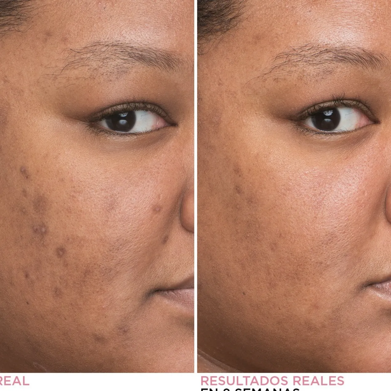 Bye Bye Dark Spots Sérum Facial Minimizador de Manchas Escuras