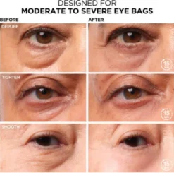Bye Bye Under Eye Bag Tratamento Anti-Olheiras