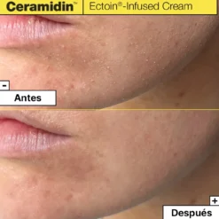 Ceramidin Creme com Ectoína
