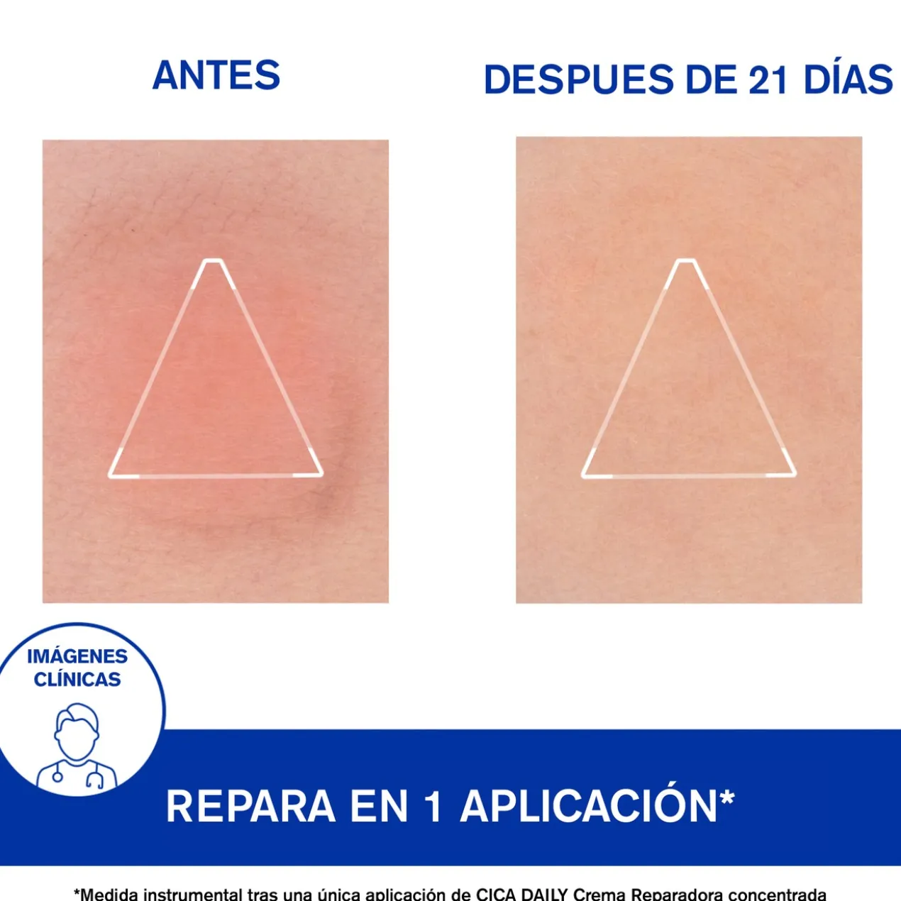 CICA Daily Gel-Creme Reparador