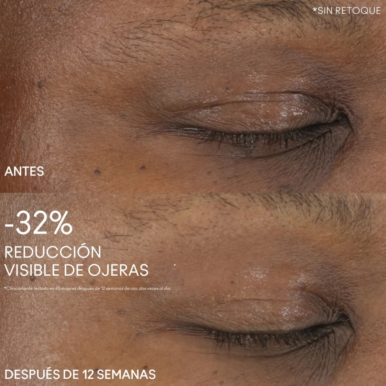 Contorno de Olhos Hyper Real Serumizer Eye