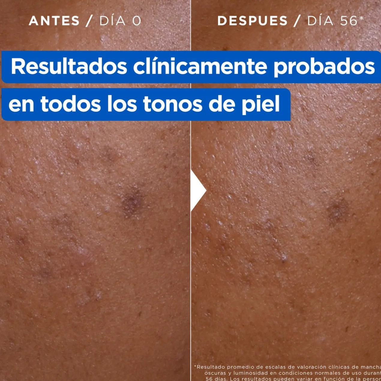 Creme Hidratante Antimanchas Niacidamide Bright