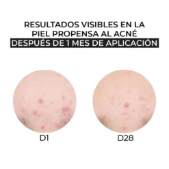 Creme Hidratante Pele Mista-Oleosa