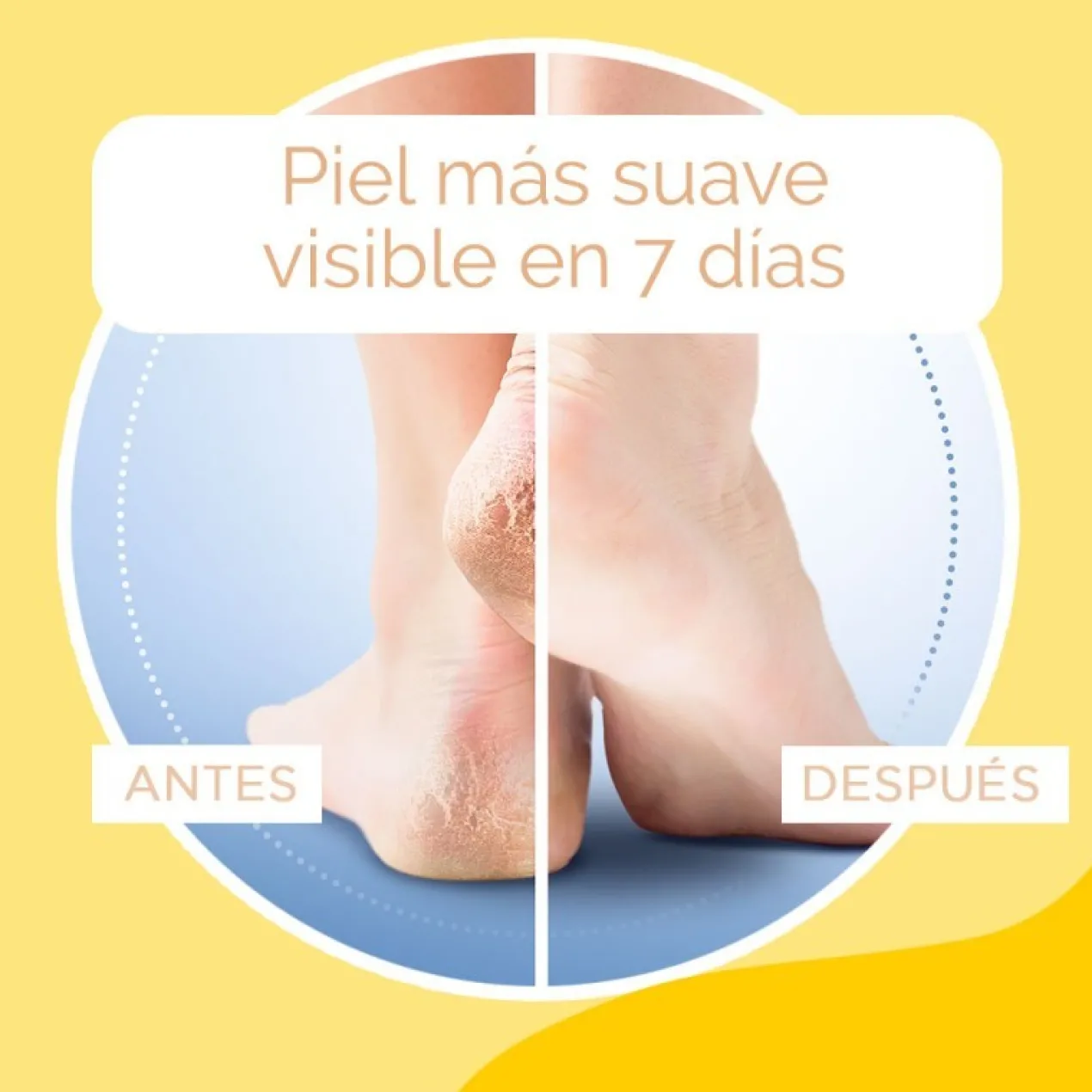 Creme para Pés com Calosidades