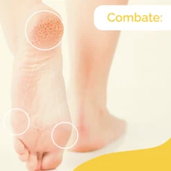 Creme para Pés com Calosidades