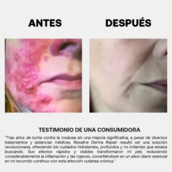 Derma Repair Creme Reparador e Calmante