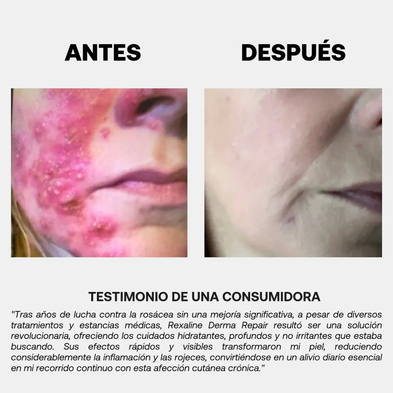 Derma Repair Creme Reparador e Calmante