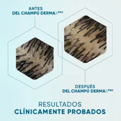 DermaXPro Champô Anticaspa Hidratante