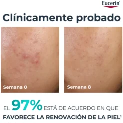 DermoPure Oill Control 10% Hirdoxiácidos