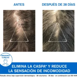 DS Hair Champô Anticaspa