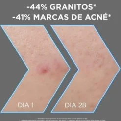 Garnier Pure Active Sérum Anti-Imperfeições com Niacinamida