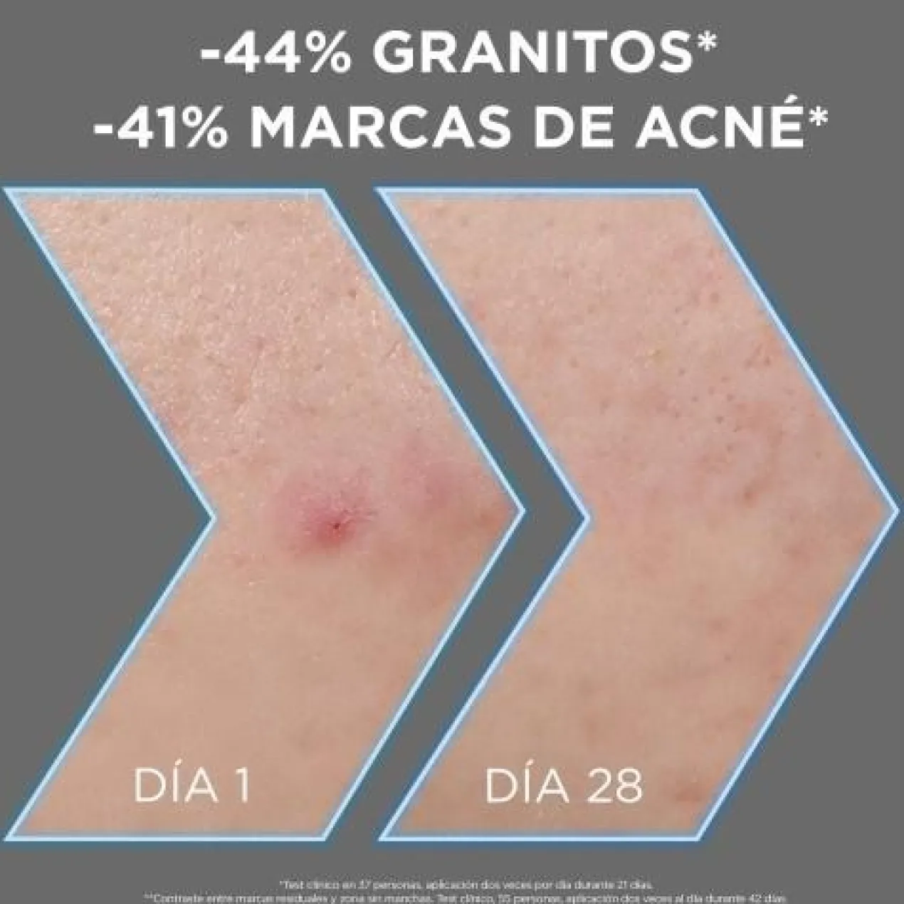 Garnier Pure Active Sérum Anti-Imperfeições com Niacinamida