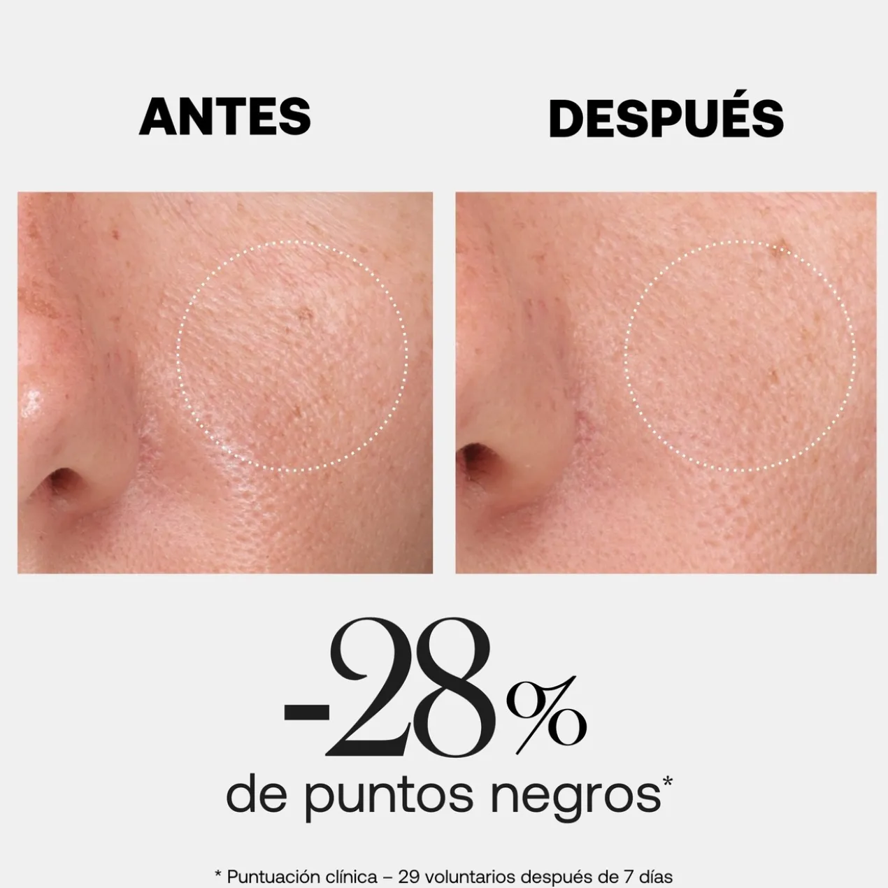 Hyalurx Boost Gel Esfoliante com Celulose