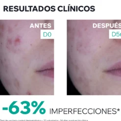 Hyséac 3-Regul+ Creme de Cuidado Global