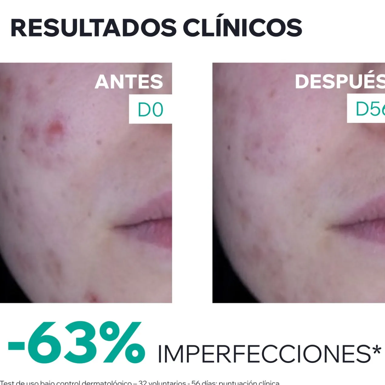 Hyséac 3-Regul+ Creme de Cuidado Global