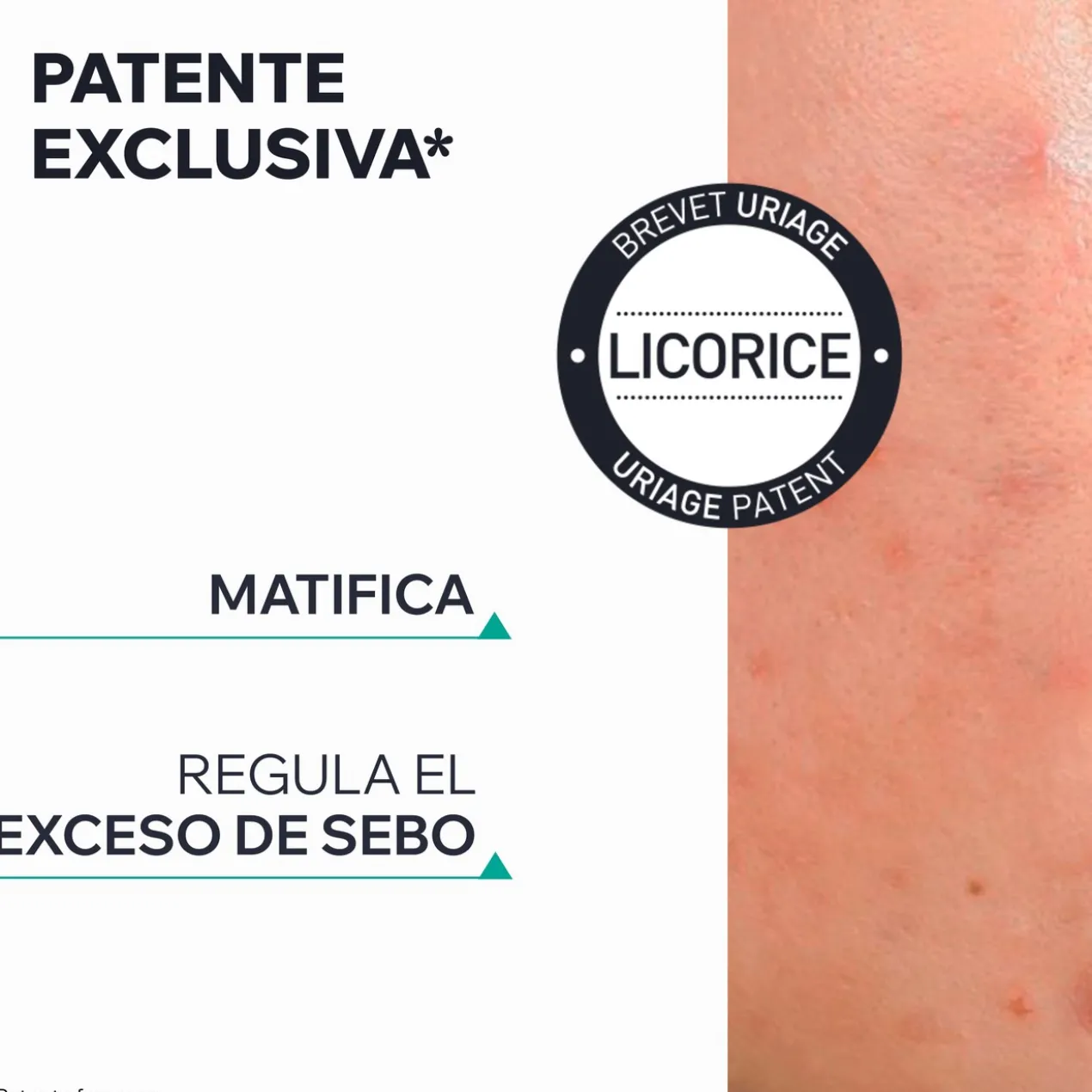Hyséac 3-Regul+ Creme de Cuidado Global