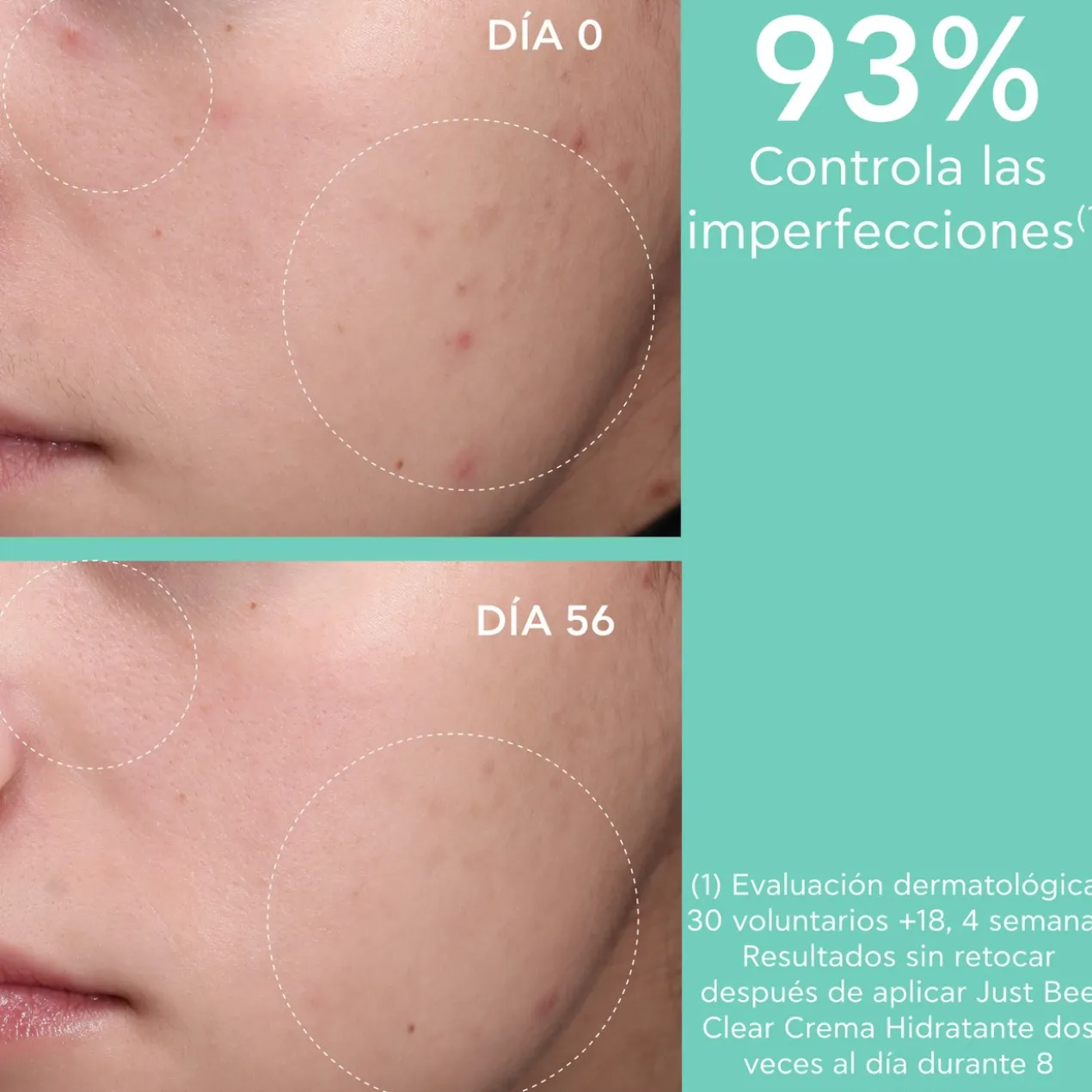 Just Bee Clear Creme Anti-Imperfeições Matificante Hidratante
