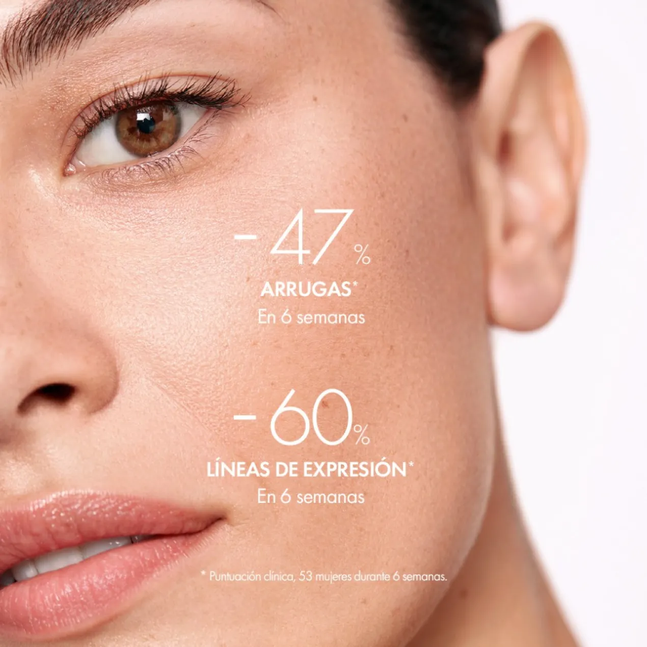 Liftactiv Supreme H.A Epidermic Filler Sérum Antirrugas