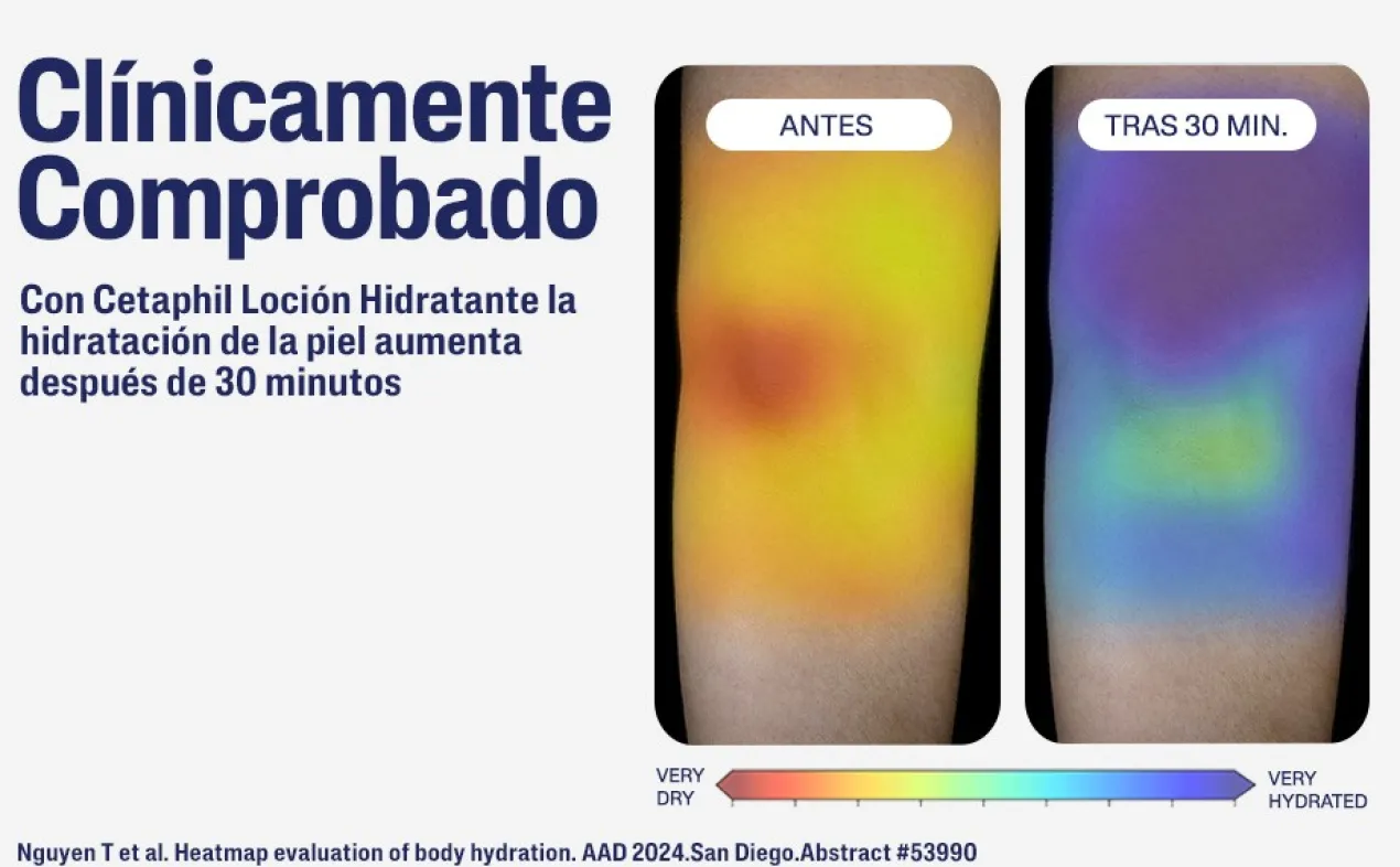 Loção Hidratante 48H