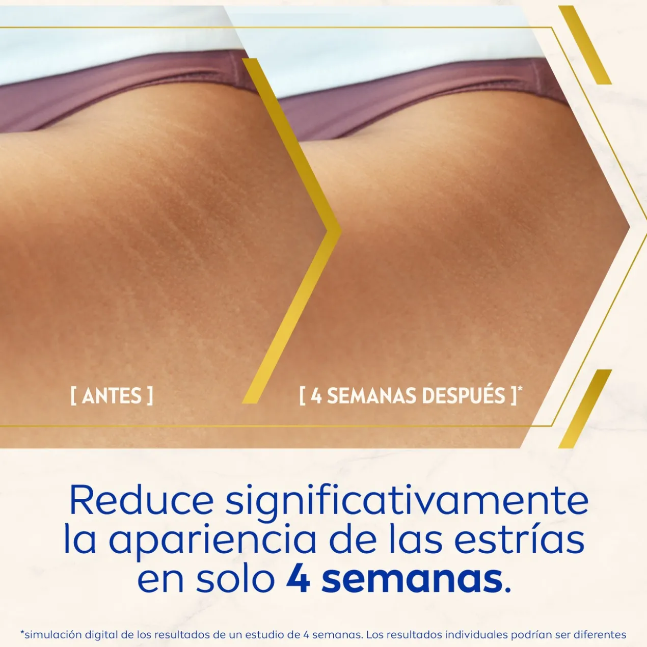 Luminous630 Sérum Corporal Antiestrias