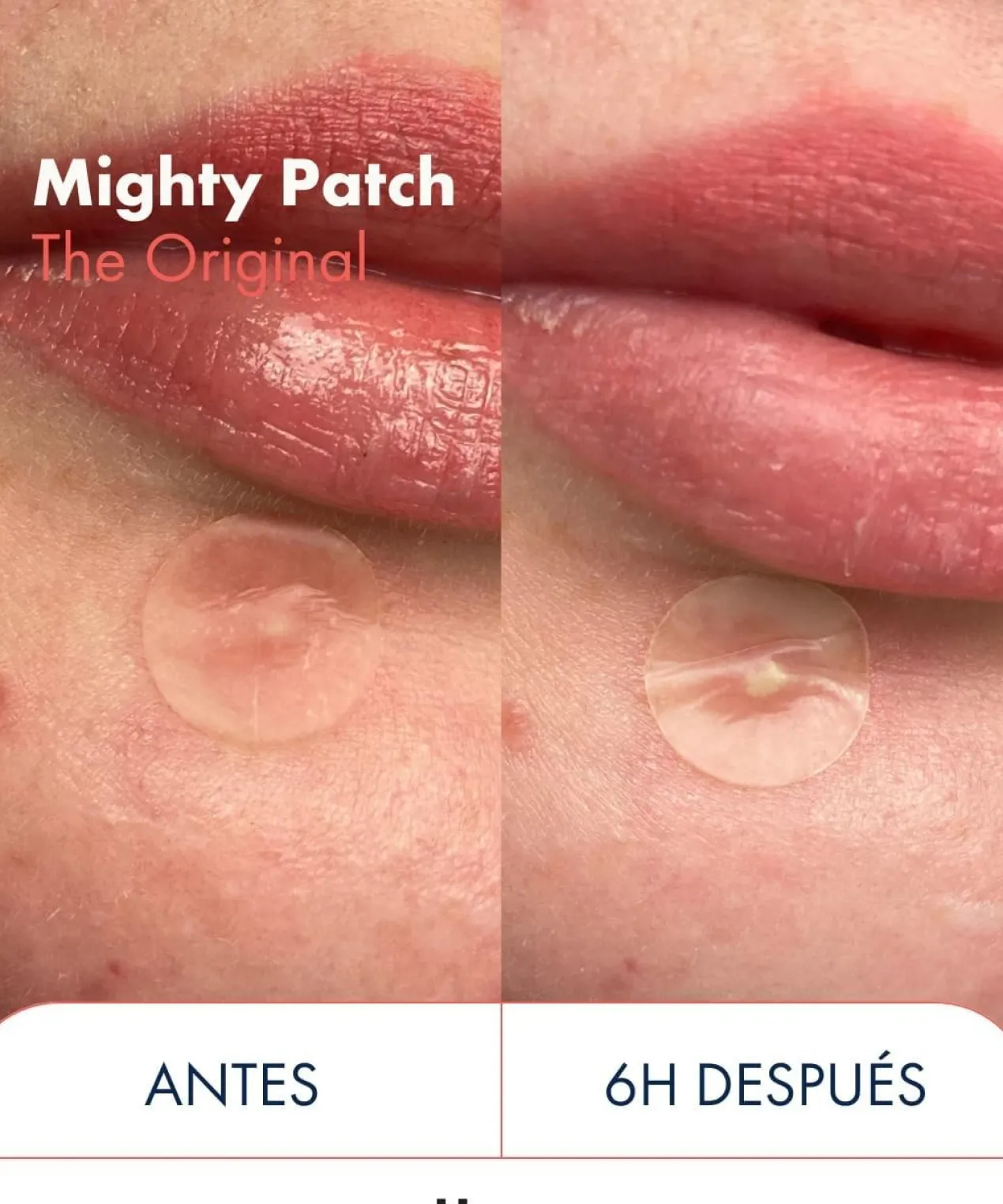 Mighty Patch The Original Patches de Hidrocoloide