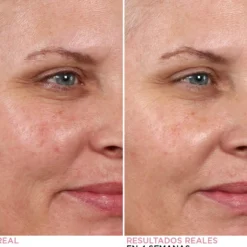 Peeling Noturno Hello Results Baby