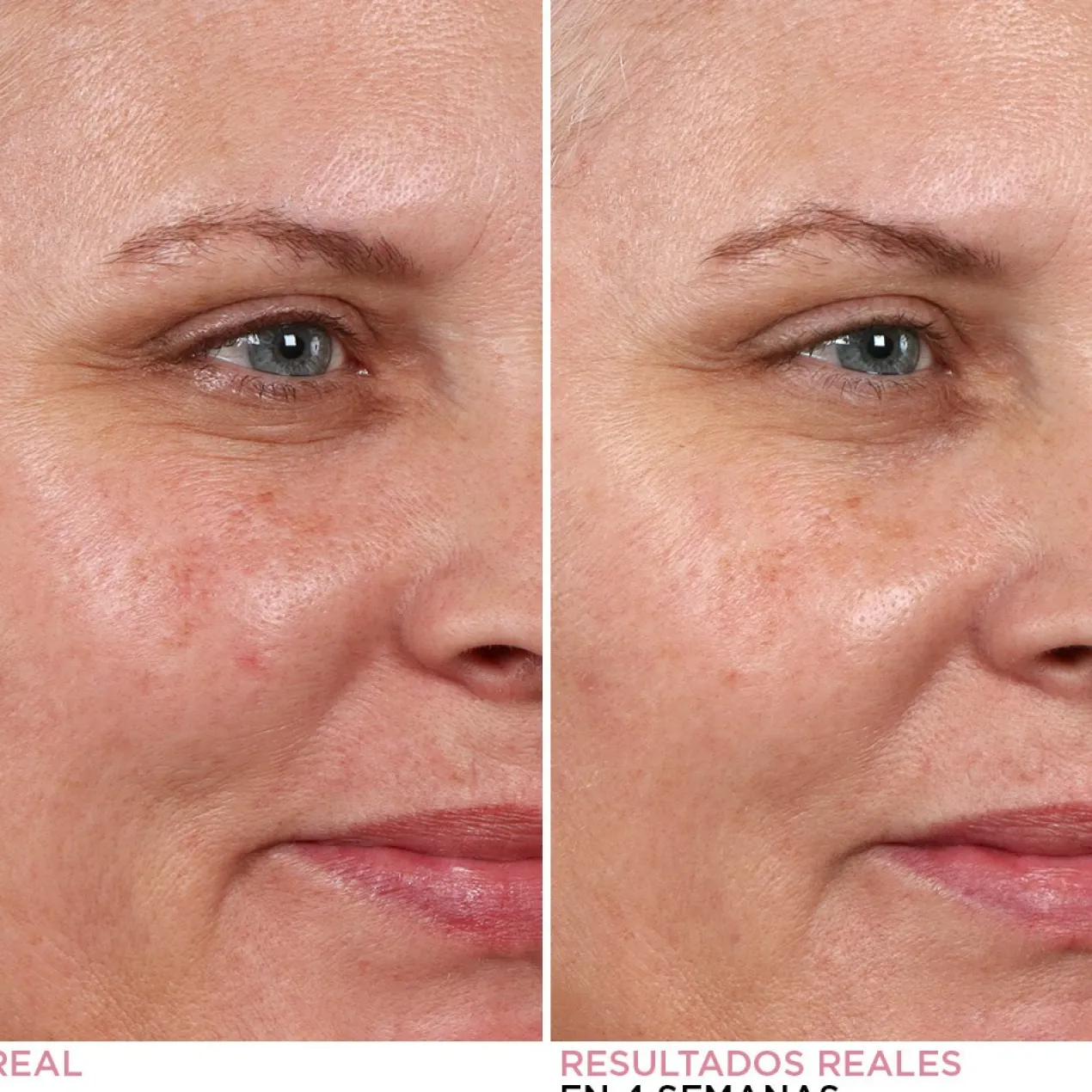 Peeling Noturno Hello Results Baby