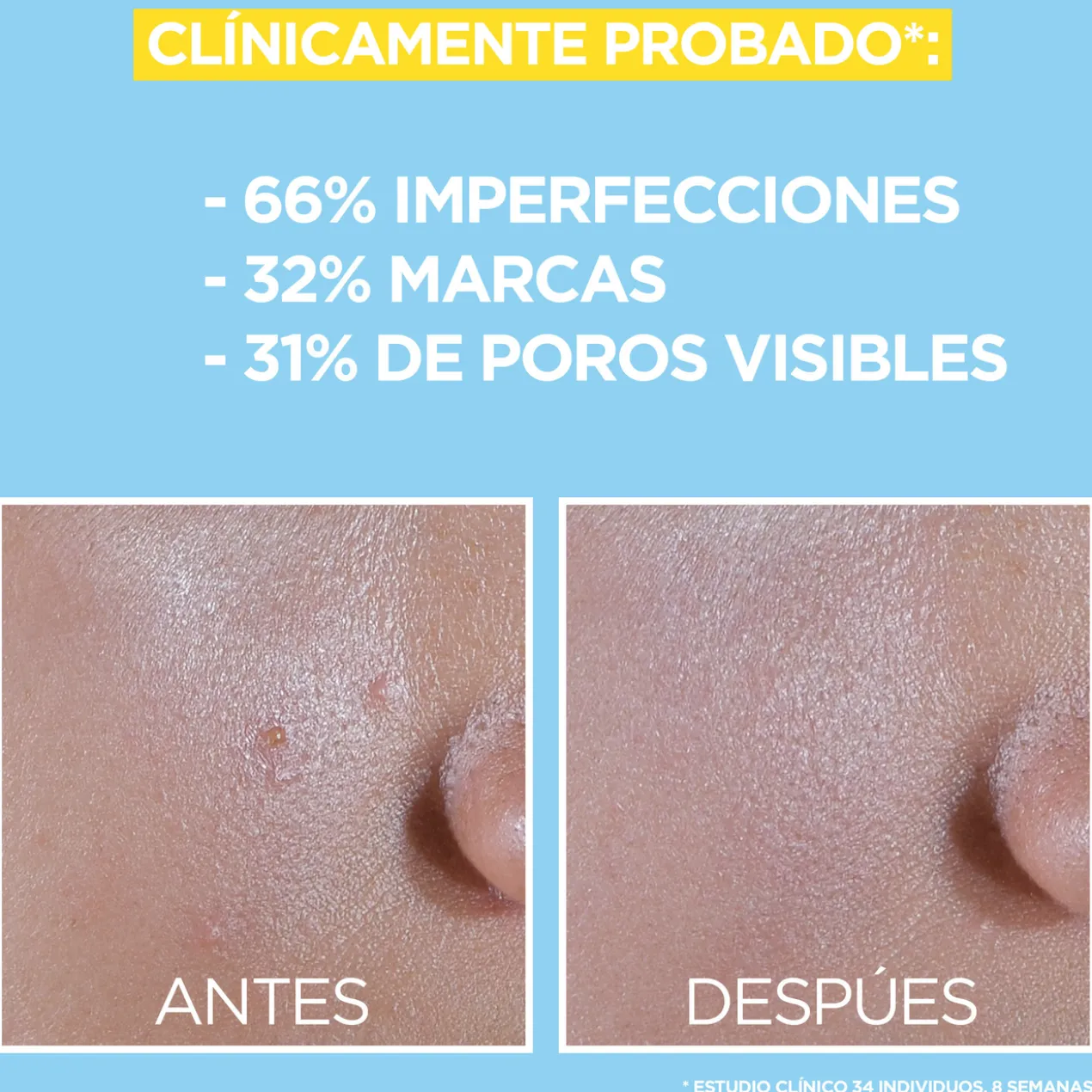 Pure Active Fluido UV com BHA + Niacinamida SPF50+