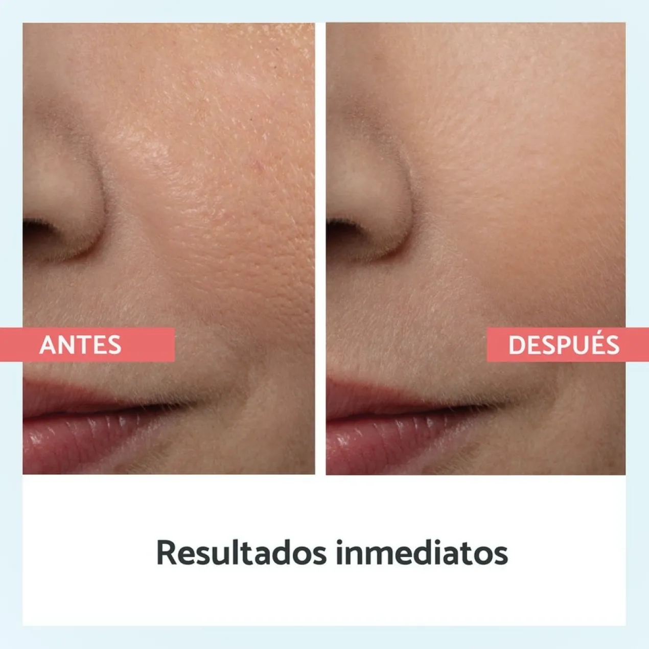 Redutor de Poros Instantâneo