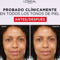 Revitalift Filler Gel Creme Preenchedor com Ácido Hialurónico