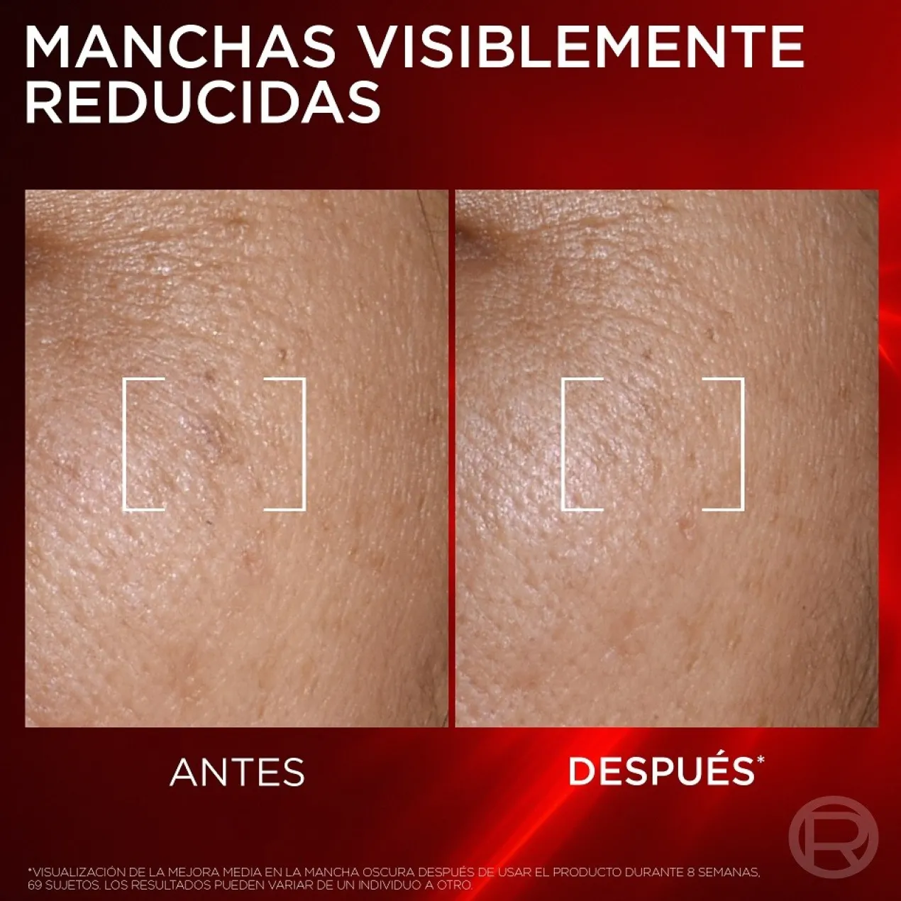 Revitalift Laser Sérum Antienvelhecimento