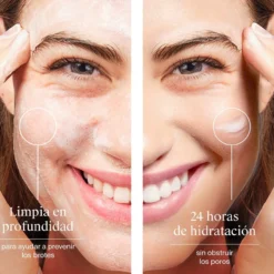 Rotina Facial Anti-Imperfeições Limpeza + Hidratação