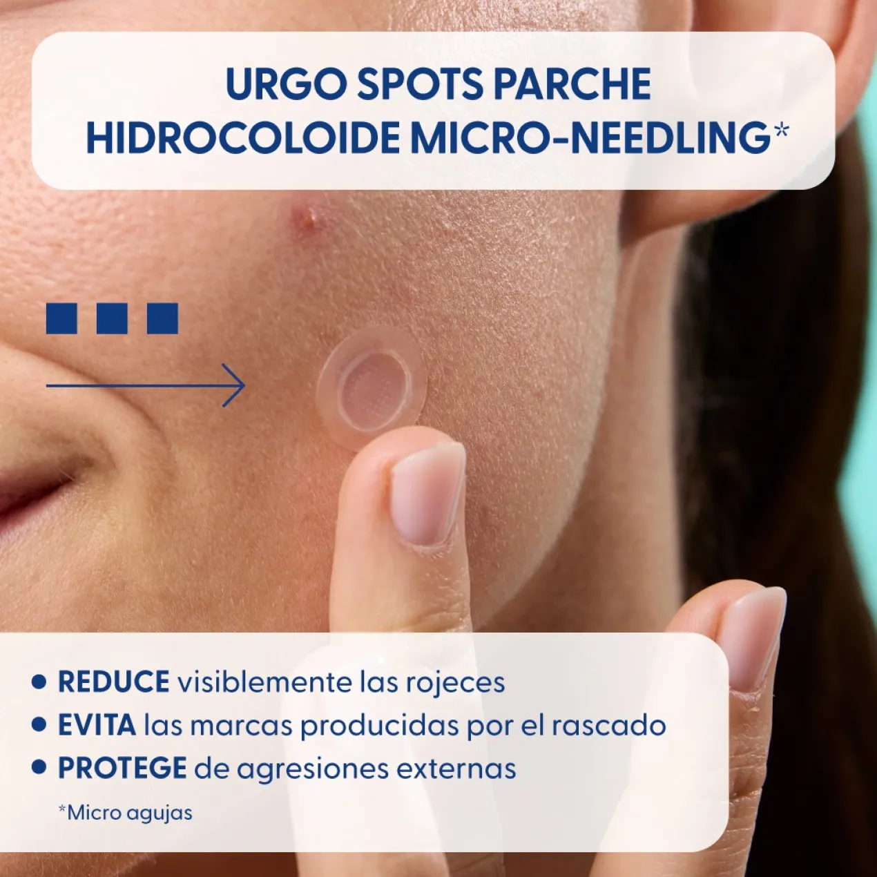 Spots Adesivos Hidrocolóide Micro-Needling Anti-Acne