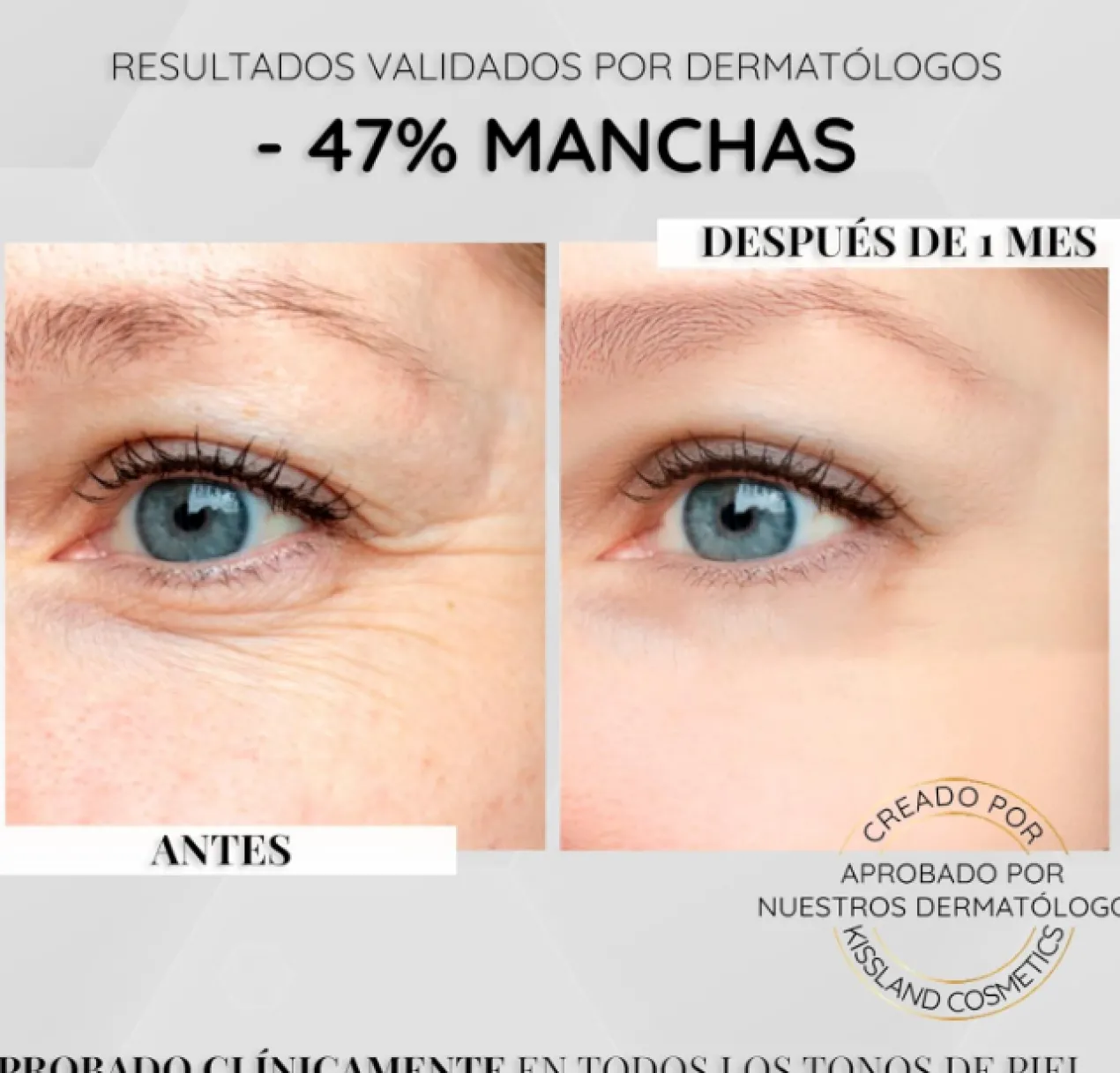 Sérum Antimanchas Facial Niacinamida