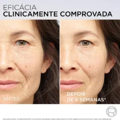 Sérum Antirrugas Revitalift Filler