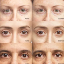 Sérum Concentrado Iluminador para Contorno de Olhos