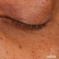 Sérum Concentrado Iluminador para Contorno de Olhos