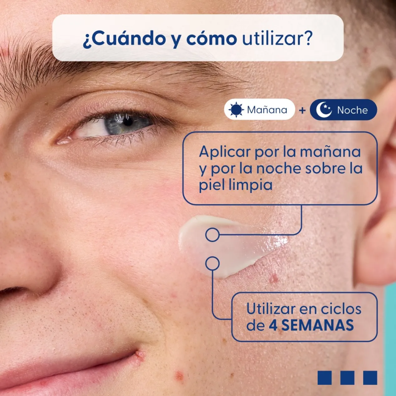 Tratamento Do Acne Concentrado Seborregulador