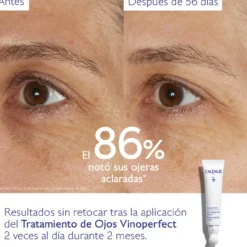 Vinoperfect Tratamento Iluminador de Olhos