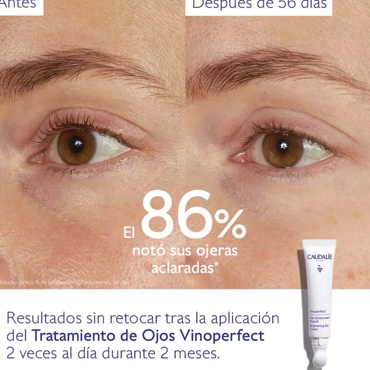 Vinoperfect Tratamento Iluminador de Olhos