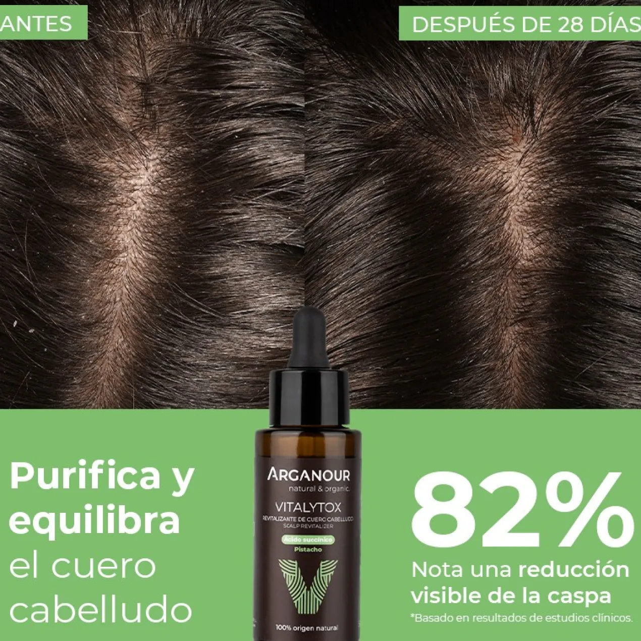 Vitalytox Revitalizante de Couro Cabeludo